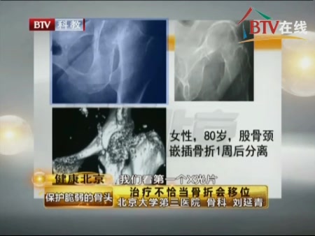 byb.cn byb.cn